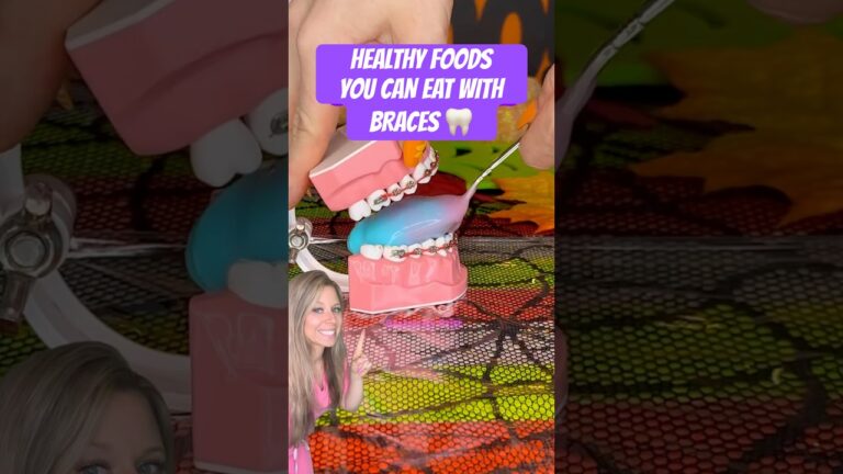 4 HEALTHY SNACKS THAT ARE SAFE FOR BRACES 🦷 #braces #food #foodasmr